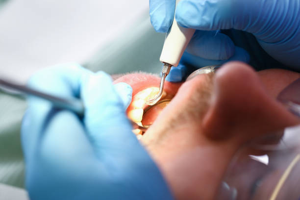 Best Emergency Treatment for Toothache in West Jefferson, OH