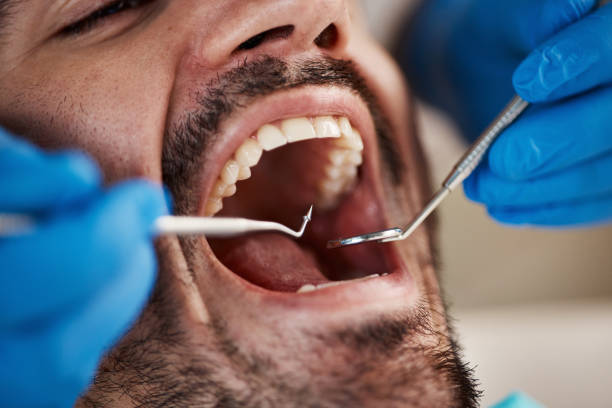 Best Emergency Dental Care for Trauma or Injury in West Jefferson, OH